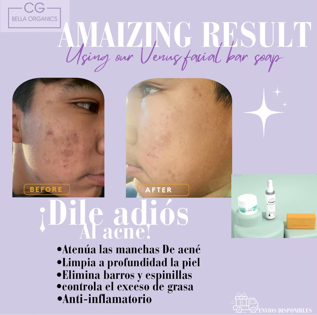 CREMA FACIAL ANTI-ACNE VENUS